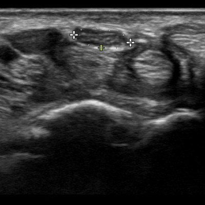 Neuromuscular Ultrasound eLearning